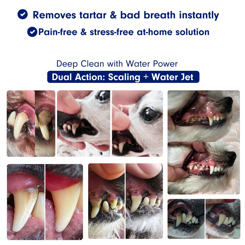 Anesthesia-Free Silent Sonic Dental System